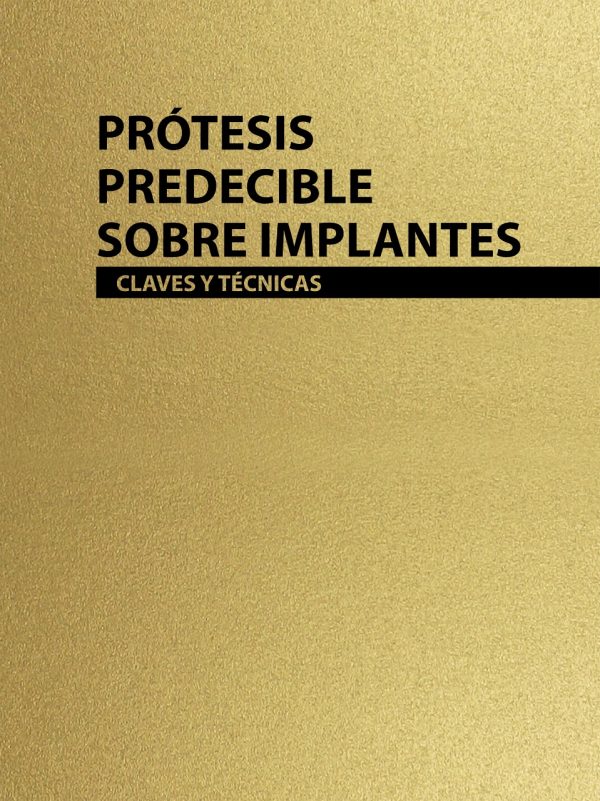 Prótesis predecibles sobre implantes - Claves y técnicas